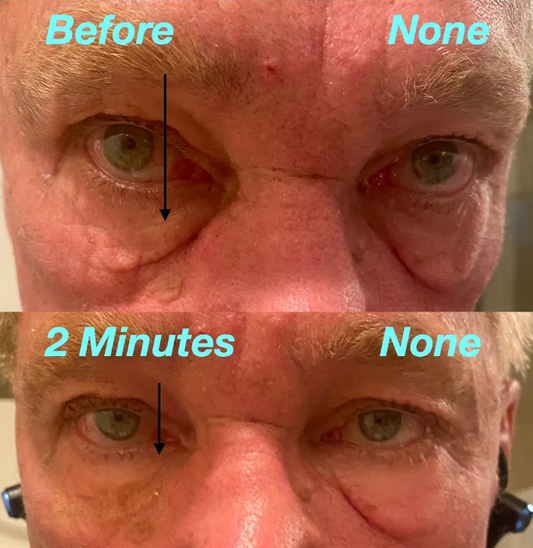 Better Than Botox Eye Serum - 30 Days Transformation