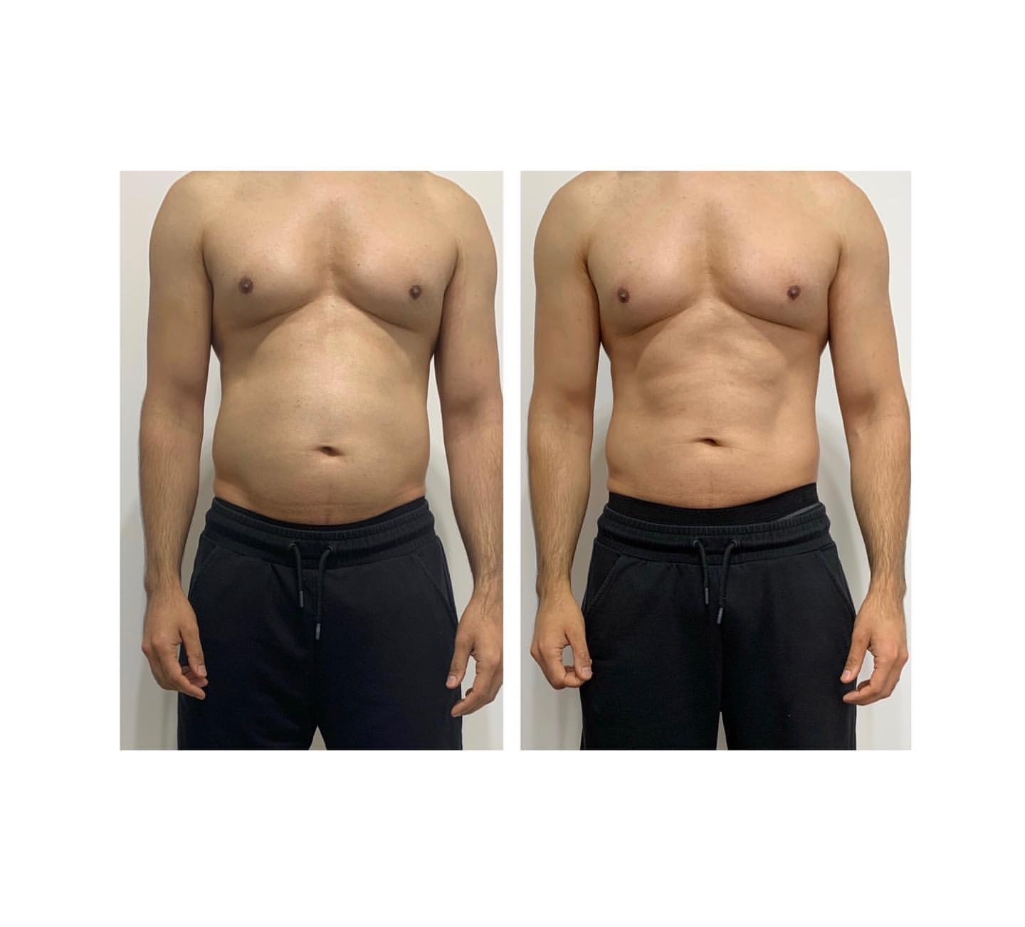 StarBody DX Smart Body Sculpting Machine