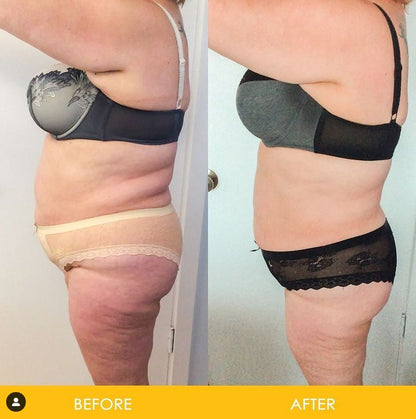 StarBody DX Smart Body Sculpting Machine