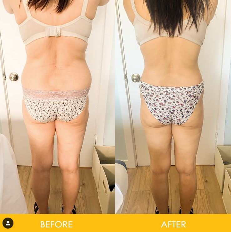 StarBody DX Smart Body Sculpting Machine