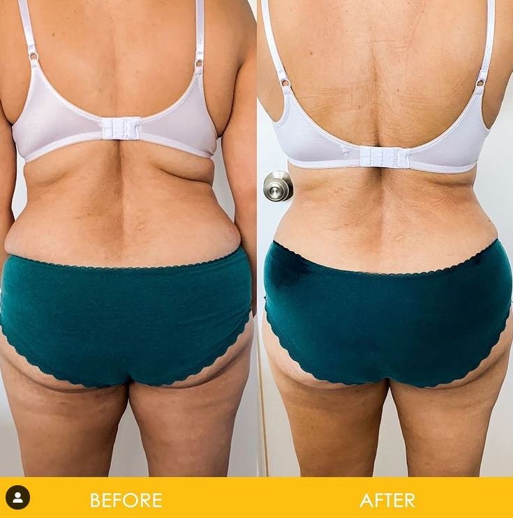 StarBody DX Smart Body Sculpting Machine