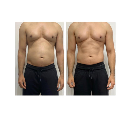 StarBody DX Smart Body Sculpting Machine