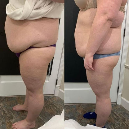StarBody DX Smart Body Sculpting Machine